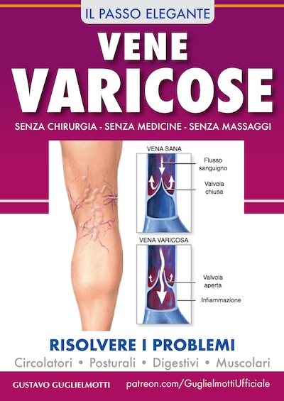 Vene varicose - Prevenire, ridurre ed eliminare