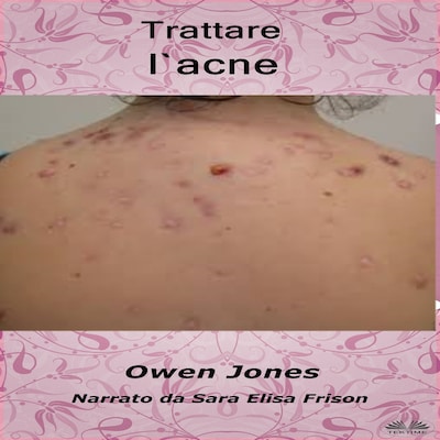 Trattare L'Acne